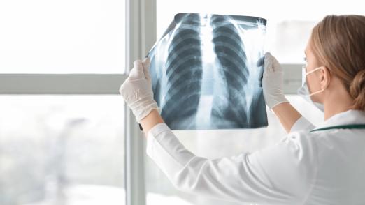 Female doctor with x-ray image of lungs in clinic