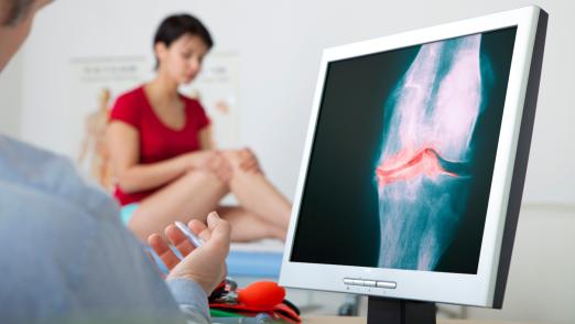 Models On screen, x-ray of a knee arthrosis